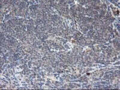 Immunohistochemistry: APP Antibody (OTI4C9) - Azide and BSA Free [NBP2-70197] - Analysis of Human lymphoma tissue.