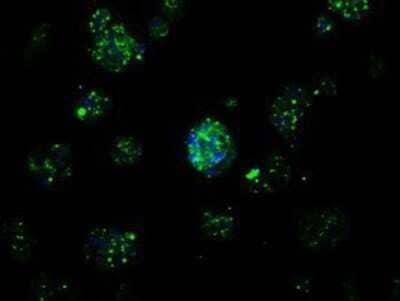 Immunocytochemistry/Immunofluorescence: APP Antibody (OTI7G9) - Azide and BSA Free [NBP2-70187] - Staining of HepG2 cells using anti-Amyloid Precursor Protein mouse monoclonal antibody.