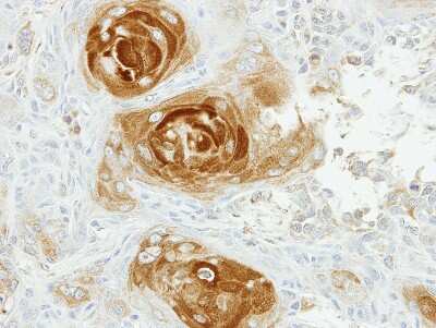 Immunohistochemistry-Paraffin: APPBP2 Antibody [NBP2-15432] - Ca922 xenograft, using APPBP2 antibody at 1:100 dilution. Antigen Retrieval: Trilogy™ (EDTA based, pH 8.0) buffer, 15min.