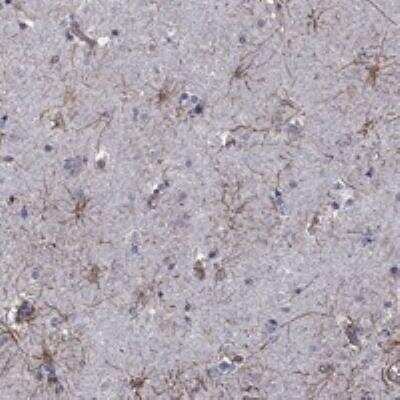 Immunohistochemistry-Paraffin: APPBP2 Antibody [NBP3-17802] - Staining of human caudate shows strong positivity in astrocytes.
