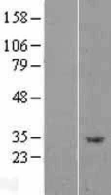 Western Blot: APPD Overexpression Lysate (Adult Normal) [NBL1-14508] Left-Empty vector transfected control cell lysate (HEK293 cell lysate); Right -Over-expression Lysate for APPD.