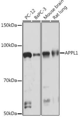 Western Blot: APPL Antibody (4M5X9) [NBP3-16721] - Western blot analysis of extracts of various cell lines, using APPL1 Rabbit mAb (NBP3-16721) at 1:1000 dilution. Secondary antibody: HRP Goat Anti-Rabbit IgG (H+L) at 1:10000 dilution. Lysates/proteins: 25ug per lane. Blocking buffer: 3% nonfat dry milk in TBST. Detection: ECL Basic Kit. Exposure time: 30s.