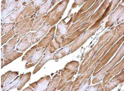 Immunohistochemistry-Paraffin: APPL Antibody [NBP2-15434] -  Mouse muscle. APPL1 antibody [N1N2], N-term dilution: 1:500. Antigen Retrieval: Trilogy™ (EDTA based, pH 8.0) buffer, 15min. 