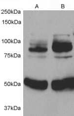 Western Blot: APPL Antibody [NB100-57841] - Staining of 1) Rat Aortic Smooth Muscle cell lysate 2) after infection with Human APPL adenovirus for 48hrs using NB100-57841 at 0.5ug/ml. Detected by chemiluminescence. Data kindly provided by Dr. L. Jia, Ann Arbor, USA.