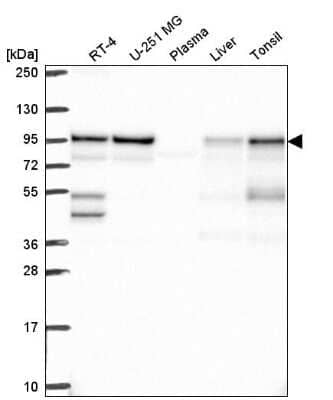 Western Blot: APPL Antibody [NBP2-76565] - Analysis in human cell line RT-4, human cell line U-251 MG, human plasma, human liver tissue and human tonsil tissue.