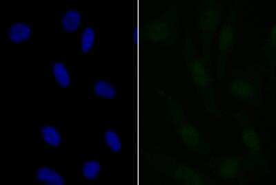 Immunocytochemistry/Immunofluorescence: APR3 Antibody [NBP2-76907] - ICC staining APR3 in SH-SY-5Y cells (green). The nuclear counter stain is DAPI (blue). Cells were fixed in paraformaldehyde, permeabilised with 0.25% Triton X100/PBS.
