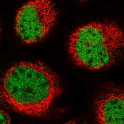 Immunocytochemistry/Immunofluorescence: APRIN Antibody [NBP1-90122] - Immunofluorescent staining of human cell line A-431 shows localization to nucleoplasm.