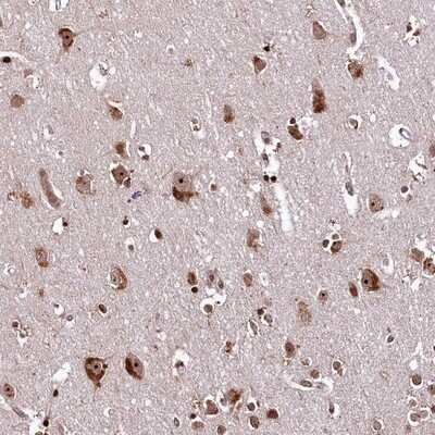 Immunohistochemistry-Paraffin: APRIN Antibody [NBP1-90122] - Staining of human cerebral cortex shows strong cytoplasmic and nucleolar/ nuclear positivity in neuronal cells.