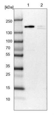 Western Blot: APRIN Antibody [NBP1-90122] - Lane 1: NIH-3T3 cell lysate (Mouse embryonic fibroblast cells). Lane 2: NBT-II cell lysate (Rat Wistar bladder tumor cells).