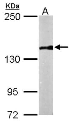 Western Blot: APRIN Antibody [NBP2-15436] - Sample (50 ug of whole cell lysate) A: Mouse brain 5% SDS PAGE; antibody diluted at 1:1000.