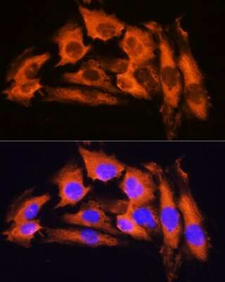 Immunocytochemistry/Immunofluorescence: APRT Antibody [NBP2-92731] - Immunofluorescence analysis of C6 cells using APRT Rabbit pAb (NBP2-92731) at dilution of 1:100. Blue: DAPI for nuclear staining.