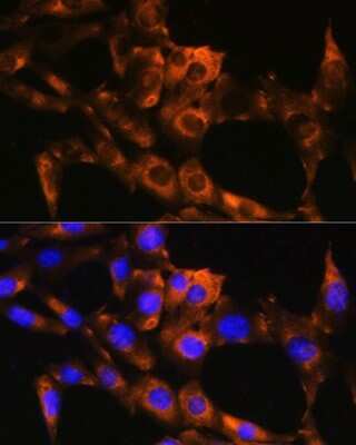 Immunocytochemistry/Immunofluorescence: APRT Antibody [NBP2-92731] - Immunofluorescence analysis of NIH/3T3 cells using APRT Rabbit pAb (NBP2-92731) at dilution of 1:100. Blue: DAPI for nuclear staining.