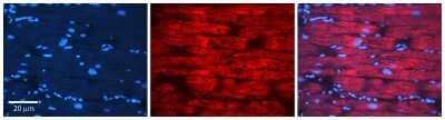 Immunohistochemistry: APRT Antibody [NBP1-55300] - Formalin Fixed Paraffin Embedded Tissue: Human heart Tissue Observed Staining: Cytoplasmic Primary Antibody Concentration: 1:100 Other Working Concentrations: N/A Secondary Antibody: Donkey anti-Rabbit-Cy3 Secondary Antibody Concentration: 1:200 Magnification: 20X Exposure Time: 0.5 - 2.0 sec