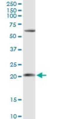 Western Blot: APRT Antibody [H00000353-D01P] - Analysis of APRT expression in K-562.