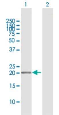 Western Blot: APRT Antibody [H00000353-D01P] - Analysis of APRT expression in transfected 293T cell line by APRT polyclonal antibody.Lane 1: APRT transfected lysate(19.60 KDa).Lane 2: Non-transfected lysate.