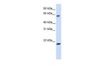 Western Blot: APRT Antibody [NBP1-55300] - Reccomended Titration: 0.2 - 1 ug/ml ELISA Titer: 1:312500 Positive Control: 293T cell lysate APRT is strongly supported by BioGPS gene expression data to be expressed in Human HEK293T cells