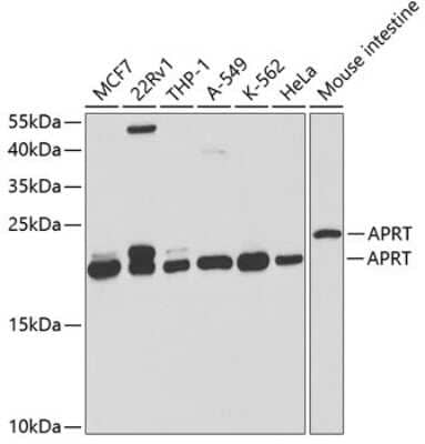 Western Blot: APRT Antibody [NBP2-92654] - Analysis of extracts of various cell lines, using APRT at 1:1000 dilution.Secondary antibody: HRP Goat Anti-Rabbit IgG (H+L) at 1:10000 dilution.Lysates/proteins: 25ug per lane.Blocking buffer: 3% nonfat dry milk in TBST.Detection: ECL Basic Kit .Exposure time: 10s.