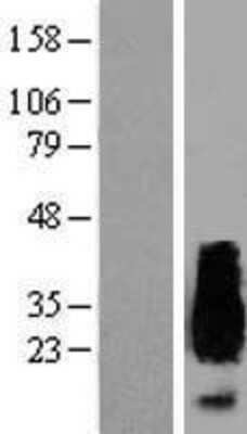 Western Blot: APRT Overexpression Lysate (Adult Normal) [NBP2-09024] Left-Empty vector transfected control cell lysate (HEK293 cell lysate); Right -Over-expression Lysate for APRT.