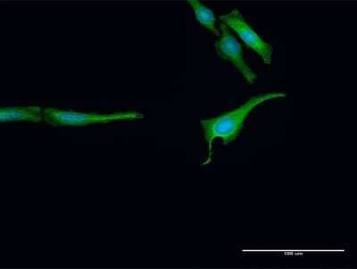 Immunocytochemistry/Immunofluorescence: ARA54 Antibody [H00009604-D01P] - Analysis of antibody to RNF14 on HeLa cell. Antibody concentration 30 ug/ml.