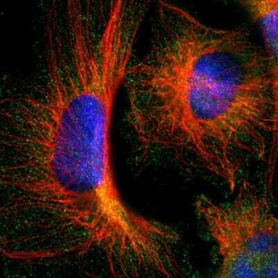 Immunocytochemistry/Immunofluorescence: ARA54 Antibody [NBP1-89021] - Staining of human cell line U-251 MG shows localization to cytosol. Antibody staining is shown in green.