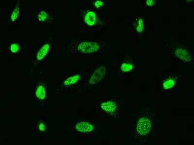 Immunocytochemistry/Immunofluorescence: ARA54 Antibody [NBP2-99042] - Immunofluorescence staining of ARA54 in Hela cells. Cells were fixed with 4% PFA, permeabilzed with 0.3% Triton X-100 in PBS, blocked with 10% serum, and incubated with rabbit anti-human ARA54 polyclonal antibody (1:1000) at 4C overnight. Then cells were stained with the Alexa Fluor(R)488-conjugated Goat Anti-rabbit IgG secondary antibody (green).Positive staining was localized to nucleus.