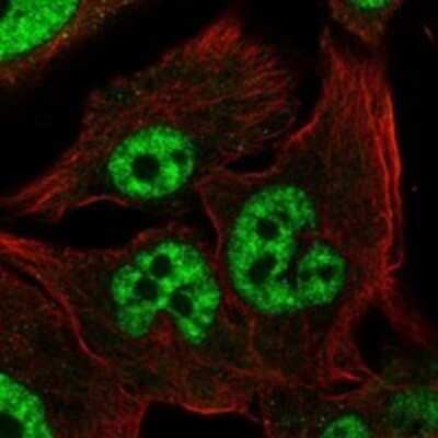 Immunocytochemistry/Immunofluorescence: ARA54 Antibody [NBP3-17686] - Staining of human cell line SK-MEL-30 shows localization to nucleoplasm.