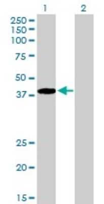 Western Blot: ARA54 Antibody [H00009604-D01P] - Analysis of RNF14 expression in transfected 293T cell line by RNF14 polyclonal antibody.Lane 1: RNF14 transfected lysate(39.60 KDa).Lane 2: Non-transfected lysate.