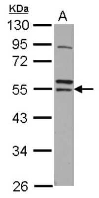 Western Blot: ARA54 Antibody [NBP2-15438] - Sample (30 ug of whole cell lysate) A: IMR32 10% SDS PAGE; antibody diluted at 1:1000.