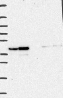 Western Blot: ARA54 Antibody [NBP3-17686] - Lane 1: Marker [kDa] 250, 130, 95, 72, 55, 36, 28, 17, 10;   Lane 2: RT4;   Lane 3: U-251 MG;   Lane 4: Human Plasma;   Lane 5: Liver;   Lane 6: Tonsil