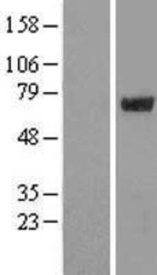 Western Blot: ARA54 Overexpression Lysate (Adult Normal) [NBL1-15425] Left-Empty vector transfected control cell lysate (HEK293 cell lysate); Right -Over-expression Lysate for ARA54.