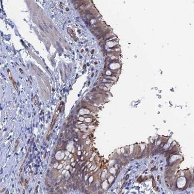 Immunohistochemistry-Paraffin ARAP3 Antibody