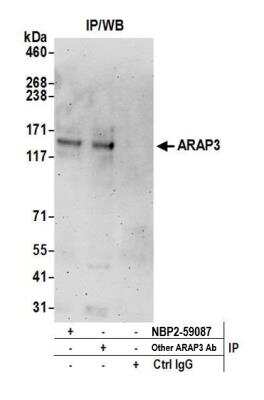 ARAP3 Antibody [NBP2-59087] - Detection of human ARAP3 by western blot of immunoprecipitates. Samples: Whole cell lysate (0.5 or 1.0 mg per IP reaction; 20% of IP loaded) from 293T cells prepared using NETN lysis buffer. Antibodies: Affinity purified rabbit anti-ARAP3 antibody NBP2-59087 used for IP at 8 ul per reaction. ARAP3 was also immunoprecipitated by another rabbit anti-ARAP3 antibody. Detection: Chemiluminescence with an exposure time of 3 minutes.