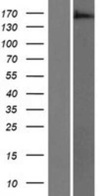 Western Blot: ARAP3 Overexpression Lysate (Adult Normal) [NBP2-06429] Left-Empty vector transfected control cell lysate (HEK293 cell lysate); Right -Over-expression Lysate for ARAP3.