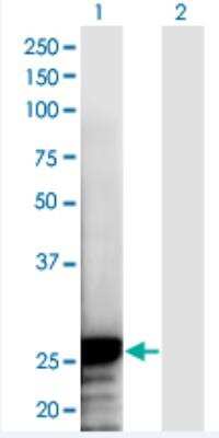 Western Blot: ARC/NOL3 Antibody (6F5) [H00008996-M03A-200ul] - Analysis of NOL3 expression in transfected 293T cell line by NOL3 monoclonal antibody (M03A), clone 6F5.  Lane 1: NOL3 transfected lysate (Predicted MW: 22.6 KDa). Lane 2: Non-transfected lysate