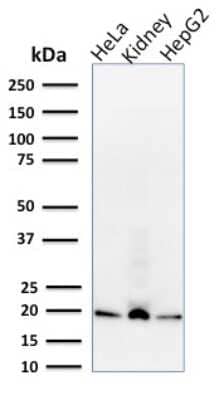 Western Blot: ARF1 Antibody (1A9/5) - Azide and BSA Free [NBP3-08340] - Western Blot Analysis of human HeLa, HepG2 cell lysates and kidney tissue lysate using ARF1 Mouse Monoclonal Antibody (1A9/5).