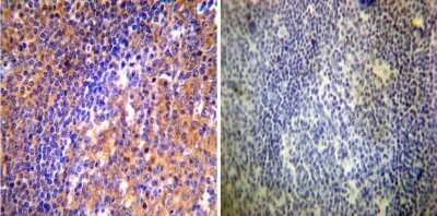Immunohistochemistry-Paraffin: ARF1 Antibody (1D9) [NB300-505] - Both normal and cancer biopsies of deparaffinized Human tonsil tissues.