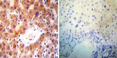 Immunohistochemistry-Paraffin: ARF1 Antibody (1D9) [NB300-505] - Both normal and cancer biopsies of deparaffinized Human liver tissues.