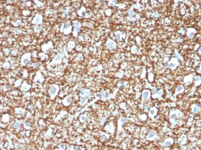 Immunohistochemistry-Paraffin: ARF1 Antibody (ARF1/2117) - Azide and BSA Free [NBP3-08473] - Formalin-fixed, paraffin-embedded human Brain stained with ARF1 Mouse Monoclonal Antibody (ARF1/2117).