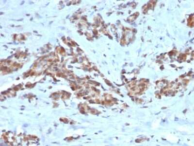 Immunohistochemistry-Paraffin: ARF1 Antibody (ARF1/2117) - Azide and BSA Free [NBP3-08473] - Formalin-fixed, paraffin-embedded human Breast stained with ARF1 Mouse Monoclonal Antibody (ARF1/2117).