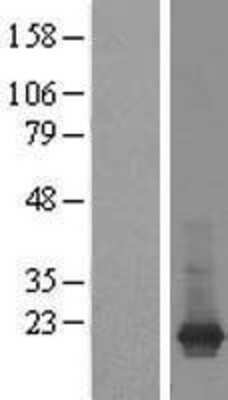 Western Blot: ARF1 Overexpression Lysate (Adult Normal) [NBP2-08660] Left-Empty vector transfected control cell lysate (HEK293 cell lysate); Right -Over-expression Lysate for ARF1.