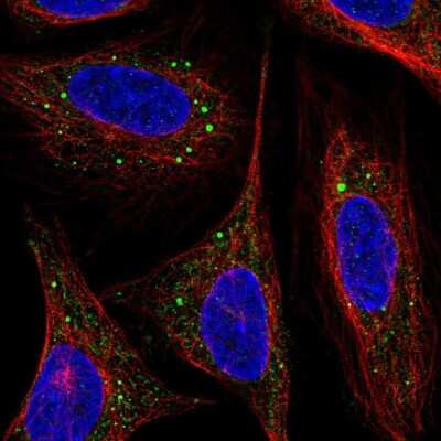 Immunocytochemistry/Immunofluorescence: ARF4L Antibody [NBP2-31820] - Immunofluorescent staining of human cell line SiHa shows localization to vesicles.