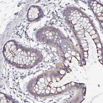 Immunohistochemistry-Paraffin: ARF4L Antibody [NBP2-31820] - Staining of human colon shows strong membranous positivity in glandular cells.