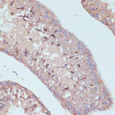 Immunohistochemistry-Paraffin ARF4L Antibody - Azide and BSA Free