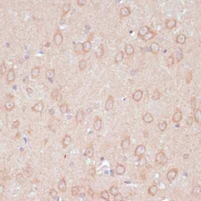 Immunohistochemistry-Paraffin: ARF4L Antibody [NBP2-92876] - Paraffin-embedded rat brain using ARF4L .