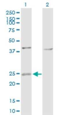 Western Blot: ARF4L Antibody [H00000379-D01P] - Analysis of ARL4D expression in transfected 293T cell line by ARL4D polyclonal antibody.Lane 1: ARL4D transfected lysate(22.20 KDa).Lane 2: Non-transfected lysate.