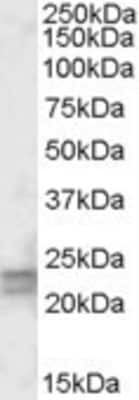 Western Blot: ARF4L Antibody [NBP1-51927] - (0.5ug/ml) staining of Human Lung lysate (35ug protein in RIPA buffer). Primary incubation was 1 hour. Detected by chemiluminescence.