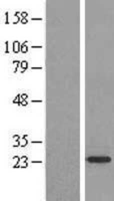 Western Blot: ARF4L Overexpression Lysate (Adult Normal) [NBL1-07696] Left-Empty vector transfected control cell lysate (HEK293 cell lysate); Right -Over-expression Lysate for ARF4L.