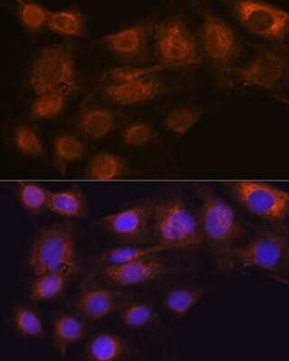 Immunocytochemistry/Immunofluorescence: ARF6 Antibody (9E7T9) [NBP3-15391] - Immunofluorescence analysis of C6 cells using ARF6 Rabbit mAb (NBP3-15391) at dilution of 1:100 (40x lens). Blue: DAPI for nuclear staining.