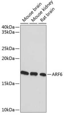 Western Blot: ARF6 Antibody (9E7T9) [NBP3-15391] - Western blot analysis of extracts of various cell lines, using ARF6 Rabbit mAb (NBP3-15391) at 1:1000 dilution. Secondary antibody: HRP Goat Anti-Rabbit IgG (H+L) at 1:10000 dilution. Lysates/proteins: 25ug per lane. Blocking buffer: 3% nonfat dry milk in TBST. Detection: ECL Basic Kit. Exposure time: 3min.