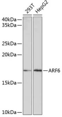 Western Blot: ARF6 Antibody (9E7T9) [NBP3-15391] - Western blot analysis of extracts of various cell lines, using ARF6 Rabbit mAb (NBP3-15391) at 1:1000 dilution. Secondary antibody: HRP Goat Anti-Rabbit IgG (H+L) at 1:10000 dilution. Lysates/proteins: 25ug per lane. Blocking buffer: 3% nonfat dry milk in TBST. Detection: ECL Enhanced Kit. Exposure time: 3min.